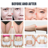 4 in 1 40K Cavitation Ultrasonic Body Slimming Machine RF Beauty Device Facial Massager Skin Tighten Face Lifting Skin Care Tool