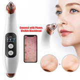 Remove blackheads visible wifi connection acne T-zone pores cleaning tool