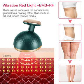 Body Slimming Machine Color light RF EMS microcurrent Ultrasonic fat bursting instrument Household shaping fat reducing instrument