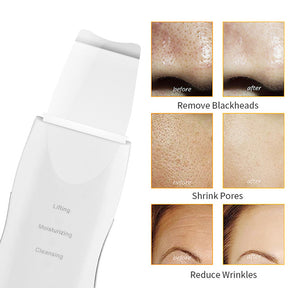 Deep Face Cleaner Machine Skin Scrubber Remove Dirt Blackhead Grease and Makeup Dirt Facial Whitening Lifting