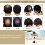 Hair Growth Comb Phototherapy Massage Comb Positive Negative Ion Hair Growth Fluid Import Comb