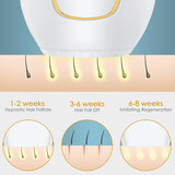Hair Removal IPL Epilator