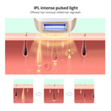 Hair Removal IPL Epilator