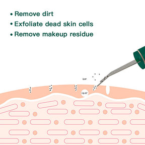 Ultrasonic Skin Deep Cleaner Peeling Shovel Facial Pore Cleaner Skin Care