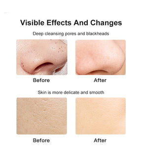 Ultrasonic Skin Deep Cleaner Peeling Shovel Facial Pore Cleaner Skin Care